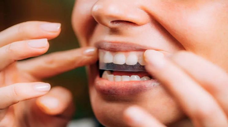 Puis-je manger après avoir utilisé les bandes de blanchiment des dents Onuge ?