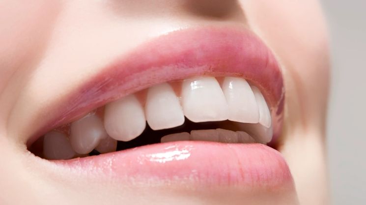 Comment utiliser le gel de blanchiment des dents en toute sécurité à la maison ? Guide complet